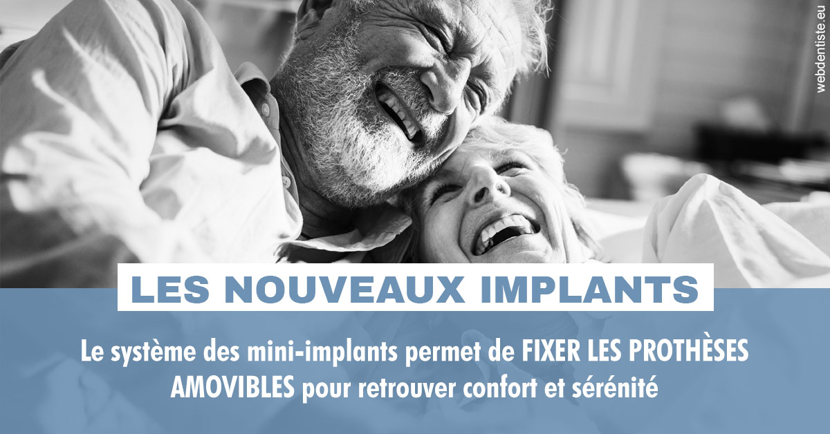 https://dr-assoun-catherine.chirurgiens-dentistes.fr/Les nouveaux implants 2