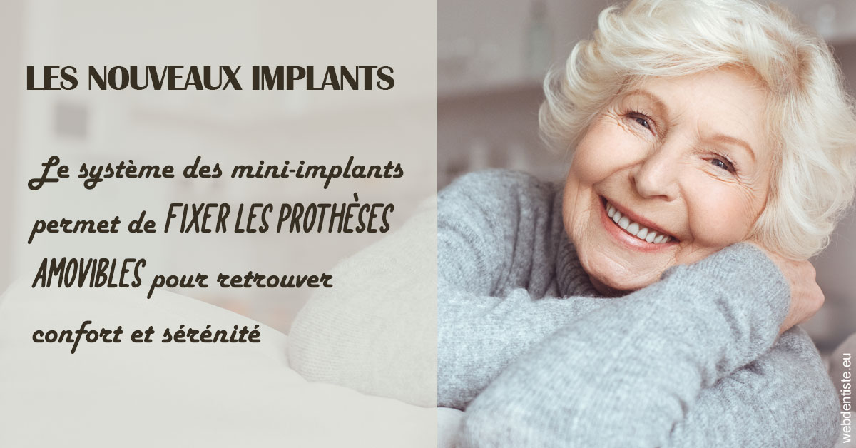 https://dr-assoun-catherine.chirurgiens-dentistes.fr/Les nouveaux implants 1