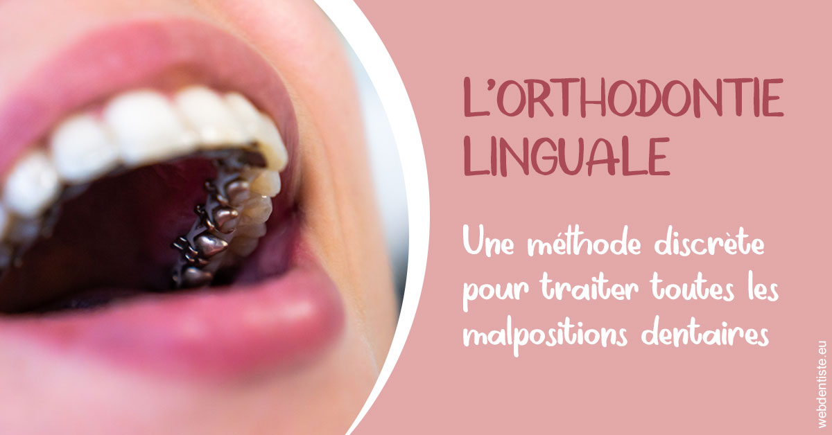 https://dr-assoun-catherine.chirurgiens-dentistes.fr/L'orthodontie linguale 2