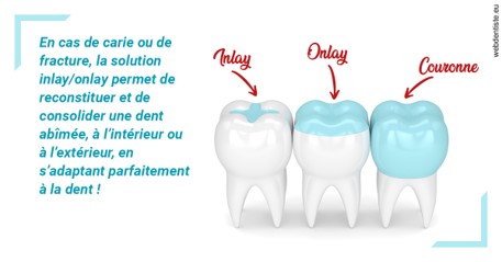 https://dr-assoun-catherine.chirurgiens-dentistes.fr/L'INLAY ou l'ONLAY