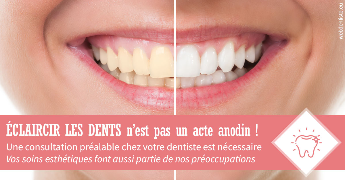 https://dr-assoun-catherine.chirurgiens-dentistes.fr/Eclaircir les dents 1