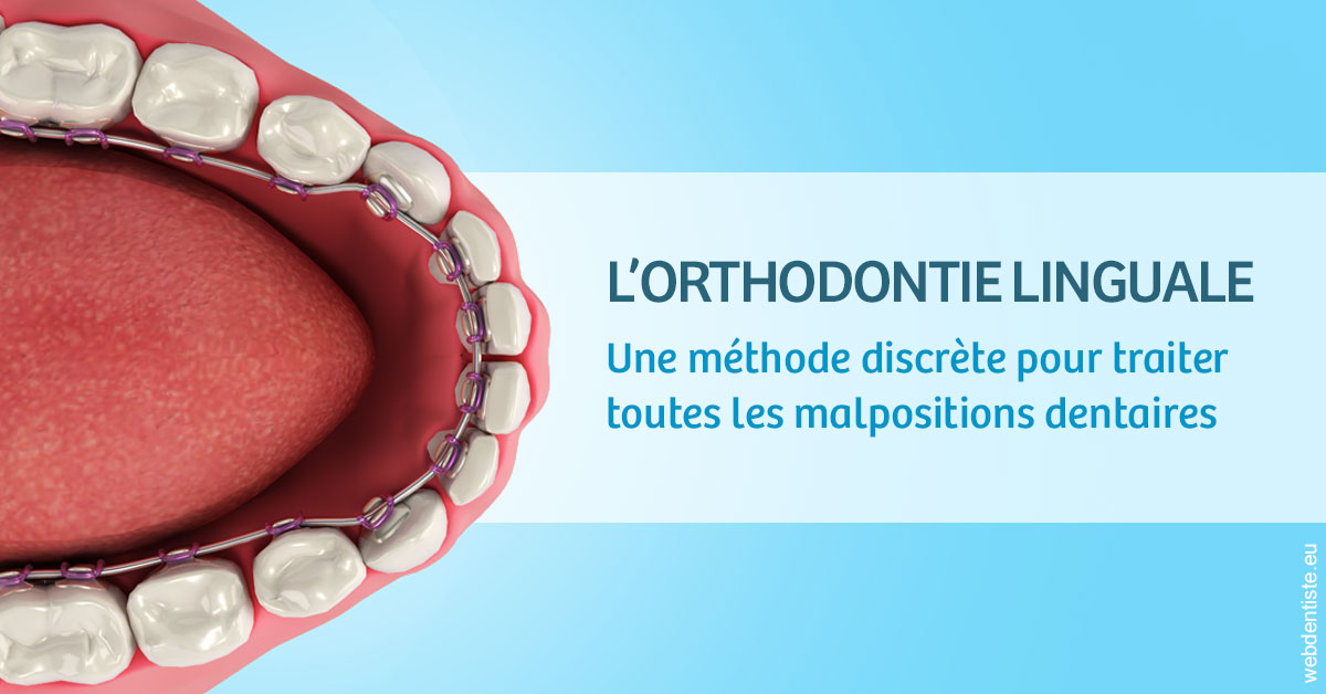 https://dr-assoun-catherine.chirurgiens-dentistes.fr/L'orthodontie linguale 1