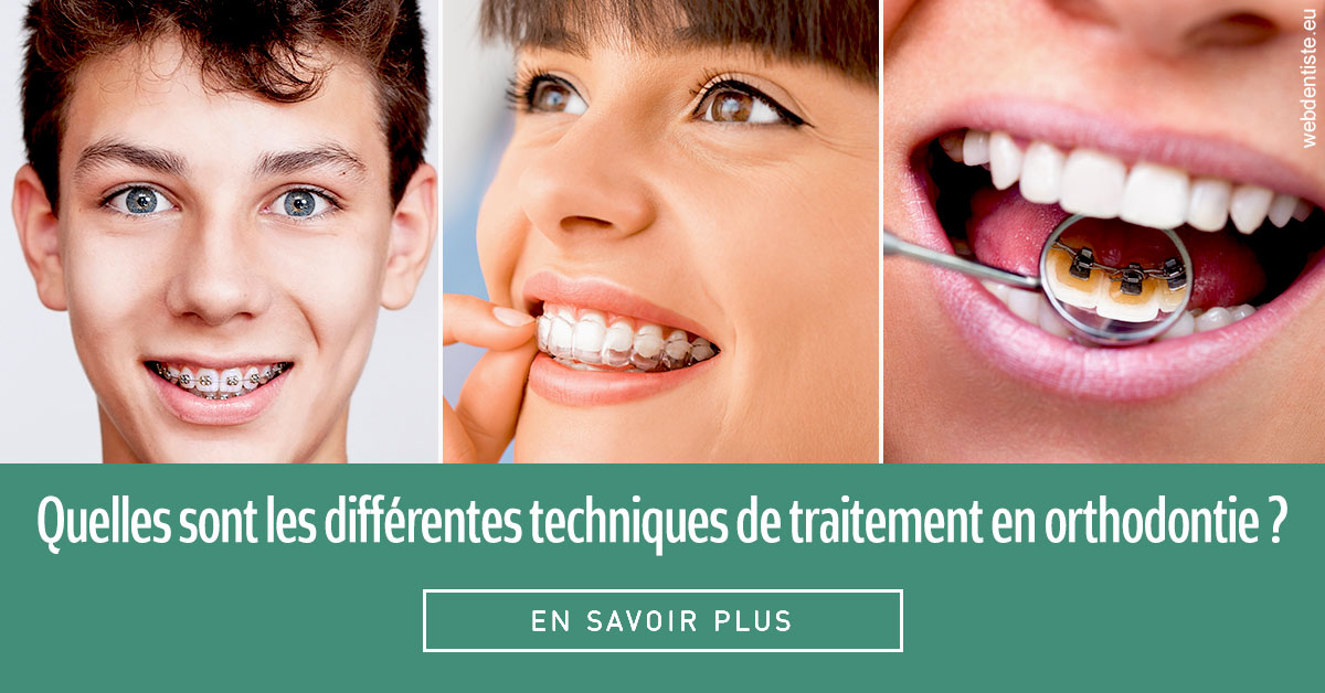 https://dr-assoun-catherine.chirurgiens-dentistes.fr/Les différentes techniques de traitement 2