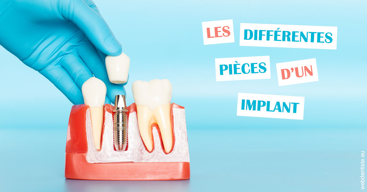 https://dr-assoun-catherine.chirurgiens-dentistes.fr/Les différentes pièces d’un implant 2
