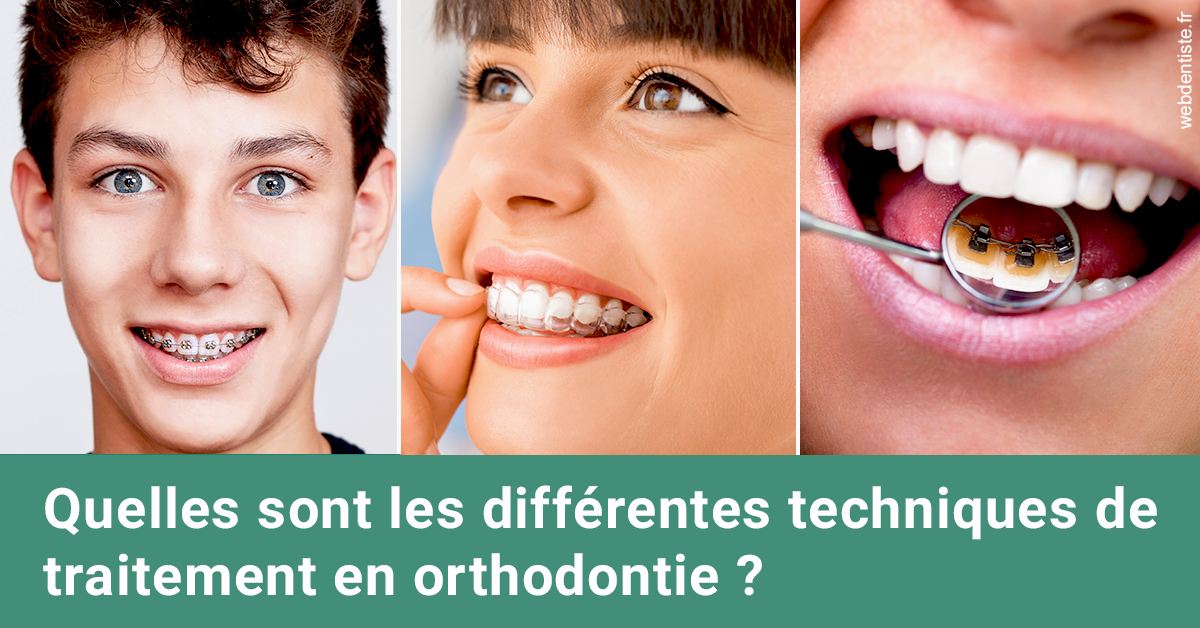 https://dr-assoun-catherine.chirurgiens-dentistes.fr/Les différentes techniques de traitement 2