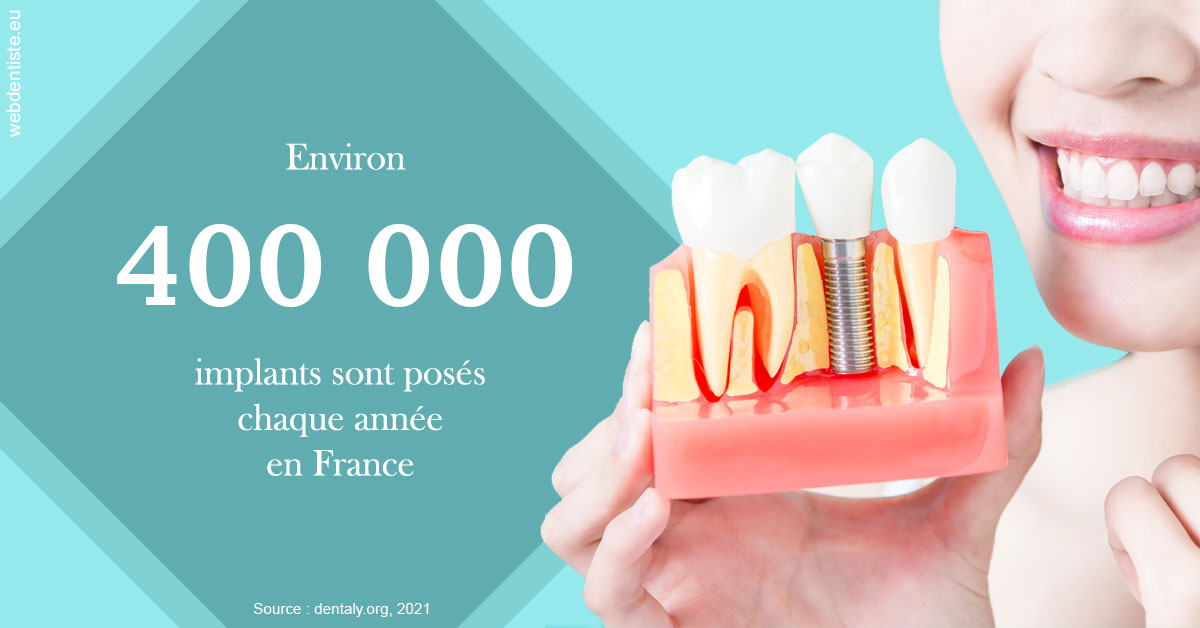 https://dr-assoun-catherine.chirurgiens-dentistes.fr/Pose d'implants en France 2