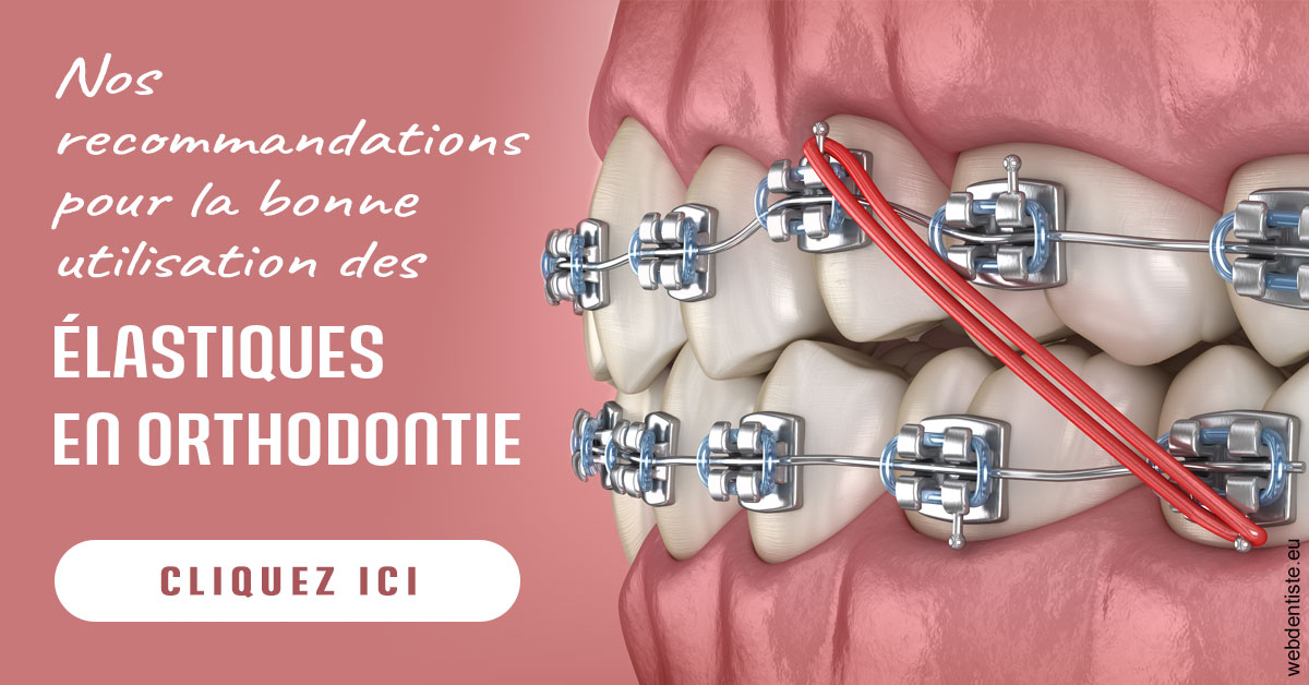https://dr-assoun-catherine.chirurgiens-dentistes.fr/Elastiques orthodontie 2